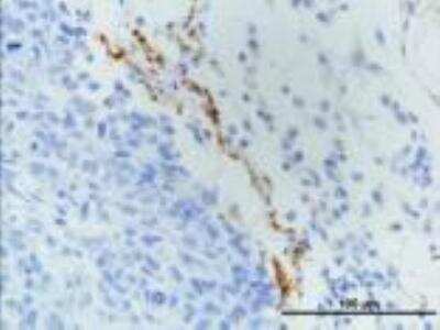 Immunohistochemistry-Paraffin: LYVE1 Antibody [DyLight 488] [NB100-725G] - IHC analysis of LYVE1 in paraffin embedded MDA-MB-231 breast cancer orthotopic transplantation tissue. Image courtesy of product review submitted by Luana Schito.